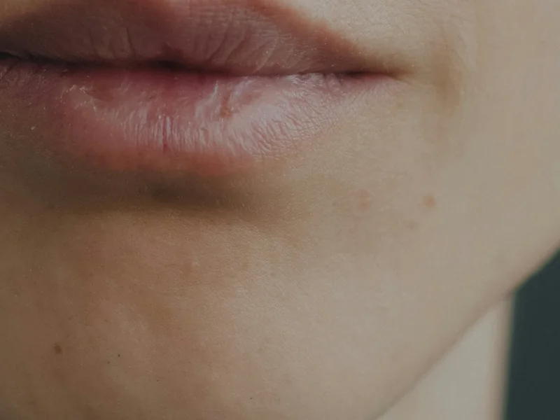Natural lips and the skin around them, close up